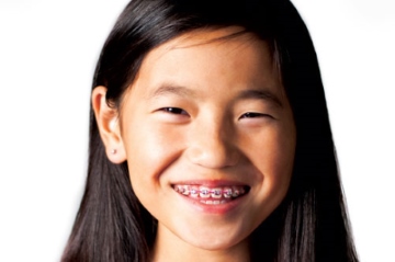 A young girl with braces smiles.