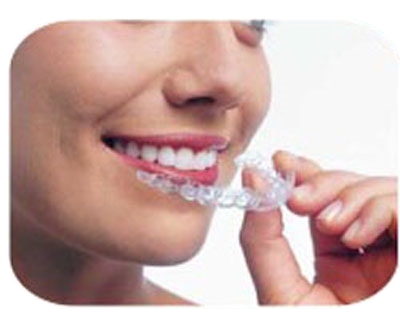 A woman puts on a top row of Invisalign.