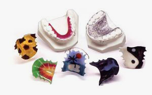 An array of retainers with custom colors and designs.